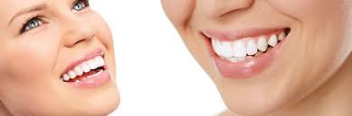 Get a Better Smile by Whitening Your Teeth